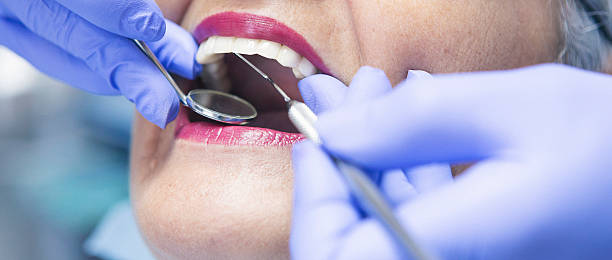 Best Emergency Dentist for Lost Fillings or Crowns in Jacksonville, NC